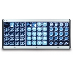 ĐÈN ĐỌC PHIM X QUANG 3 CỬA DILOS